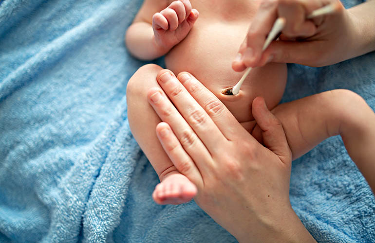 Mẹ dùng tăm bông khô vệ sinh rốn cho bé để tránh nhiễm trùng.