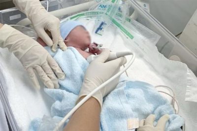 Thai nhi đầu tiên ở Việt Nam được sửa tim chào đời khỏe mạnh