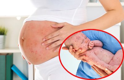 Cẩn trọng căn bệnh nguy hiểm sản phụ cần tránh trong suốt thai kỳ