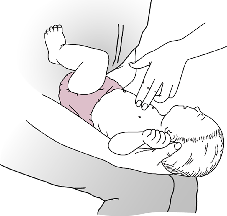 Sơ cứu trẻ bị hóc dị vật