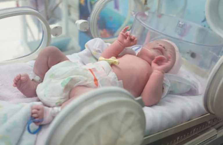 Trẻ sơ sinh mắc hội chứng hít ối phân su