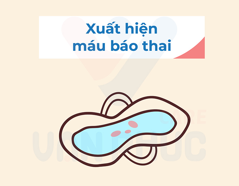 Dấu hiệu có thai: Máu báo thai