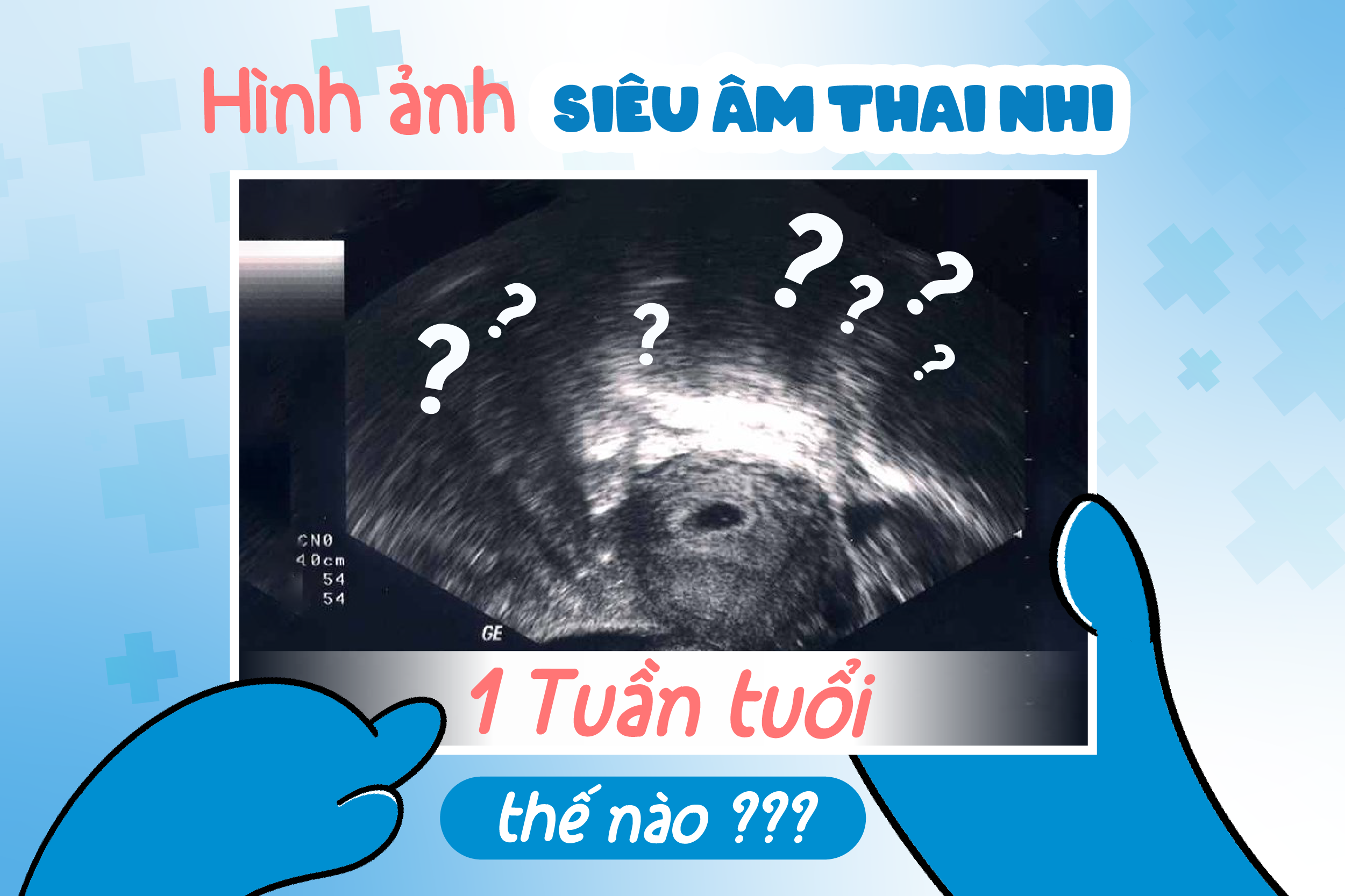 hình ảnh siêu âm thai nhi tuần 1