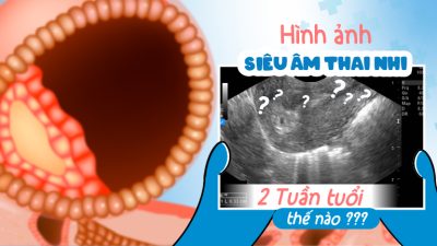 Hình ảnh siêu âm thai nhi 2 tuần tuổi có phát hiện được không?
