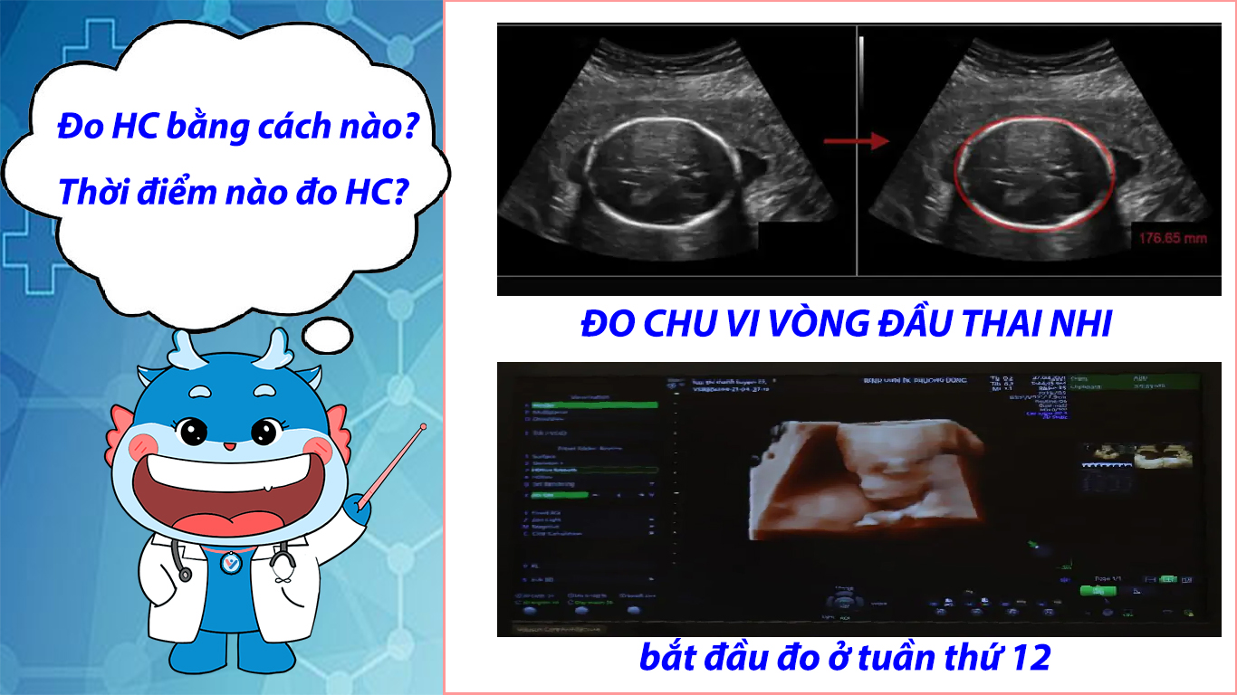 Đo chu vi vòng đầu thai nhi