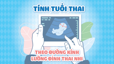 Cách Tính Tuổi Thai Theo Đường Kính Lưỡng Đỉnh Thai Nhi